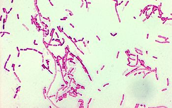 esemplari di batteri appartenenti a Moraxella osloensis trovati all'interno delle spugne da cucina