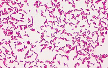 pseudomonas aeruginosa gram stain