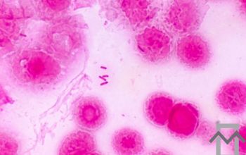 Achromobacter xylosoxidans Gram stain