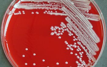 Acinetobacter baumannii Blood Agar 24h culture incubated with CO2