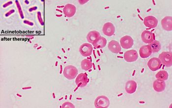 Acinetobacter baumannii Gram stain