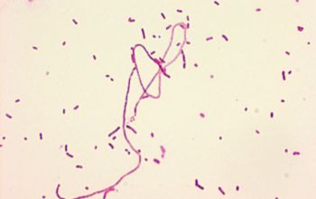 Actinobacillus ureae Gram stain