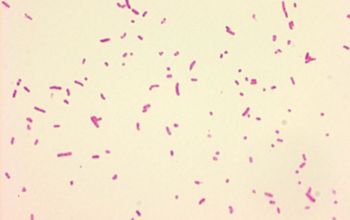 Actinobacillus ureae Gram stain