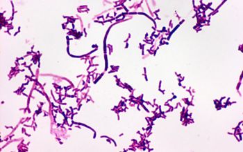 Actinomyces graevenitzii Gram stain