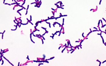 Actinomyces graevenitzii Gram stain