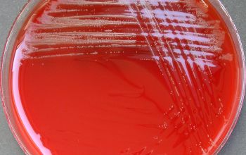 Schaalia odontolytica / Actinomyces odontolyticus Blood Agar 24h culture incubated with CO2