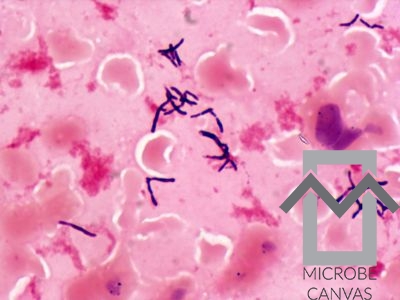 Actinomyces oris