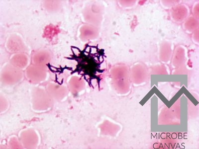 Actinomyces oris