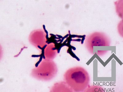 Actinomyces oris