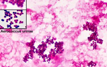 Aerococcus urinae Gram stain