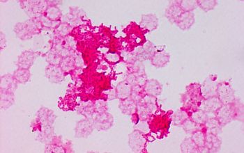 Aggregatibacter actinomycetemcomitans Gram stain