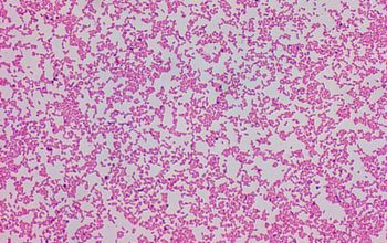 Aggregatibacter actinomycetemcomitans Gram stain