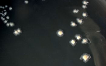 Aggregatibacter actinomycetemcomitans  culture incubated with CO2