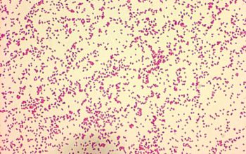 Aggregatibacter aphrophilus Gram stain
