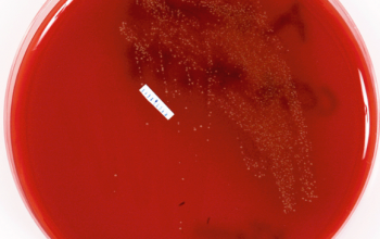 Alloiococcus otitidis  culture incubated with CO2