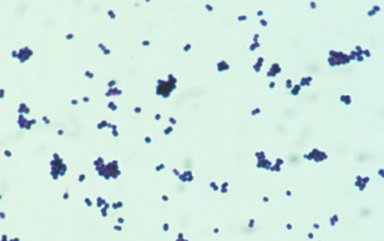 Alloiococcus otitidis Gram stain
