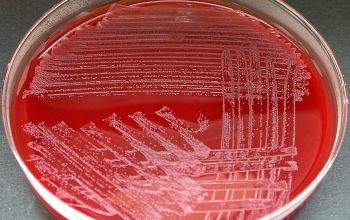Arcanobacterium haemolyticum Blood Agar 24h culture incubated with CO2