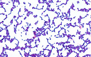 Arcanobacterium haemolyticum Gram stain