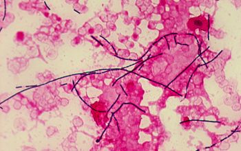 Bacillus anthracis Gram stain