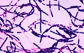 Bacillus anthracis Gram stain