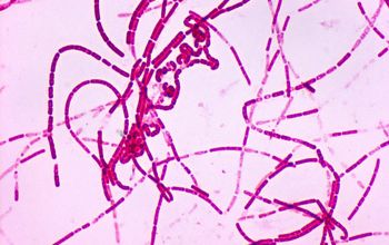 Bacillus anthracis Wirtz stain