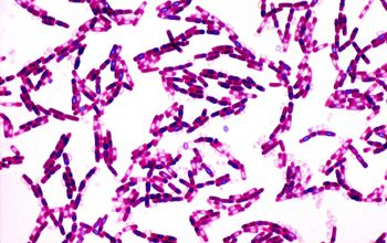 Bacillus cereus Gram stain