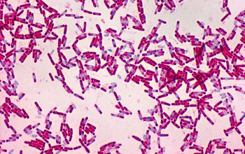 Bacillus cereus Wirtz stain
