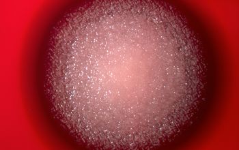 Bacillus cereus Blood Agar 24h culture incubated with O2