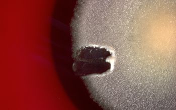 Bacillus cereus Blood Agar 48h culture incubated with O2
