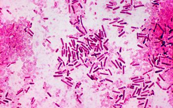 Bacillus circulans Gram stain