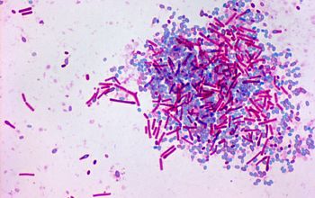 Bacillus circulans Wirtz stain