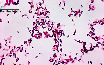 Bacillus lentus Gram stain