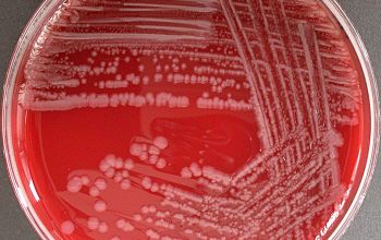 Bacillus lentus Blood Agar 48h culture incubated with O2