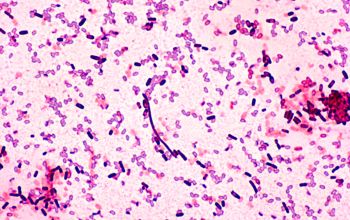 Bacillus licheniformis Gram stain