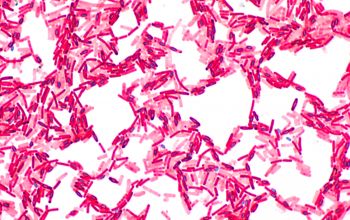 Bacillus licheniformis Wirtz stain