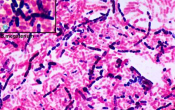 Bacillus megaterium Gram stain
