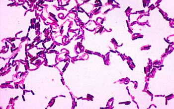 Bacillus mycoides Gram stain