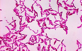 Bacillus mycoides Wirtz stain