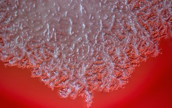 Bacillus mycoides Blood Agar 24h culture incubated with O2