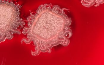 Bacillus mycoides Blood Agar 48h culture incubated with O2