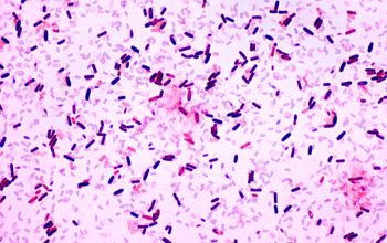 Bacillus pumilus Gram stain