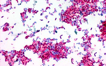 Bacillus pumilus Gram stain