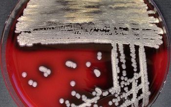 Bacillus pumilus Blood Agar 24h culture incubated with O2
