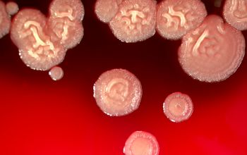 Bacillus pumilus Blood Agar 24h culture incubated with O2