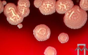 Bacillus pumilus Blood Agar 24h culture incubated with O2