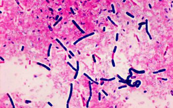 Bacillus thuringiensis Gram stain
