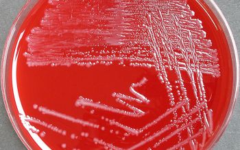 Bacteroides fragilis Brucella Blood Agar 48h culture anaerobicly incubated