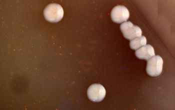 Bacteroides fragilis  culture anaerobicly incubated