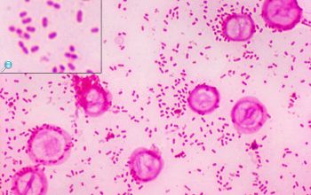 Bacteroides fragilis Gram stain