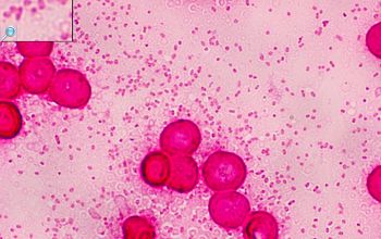 Bacteroides uniformis Gram stain